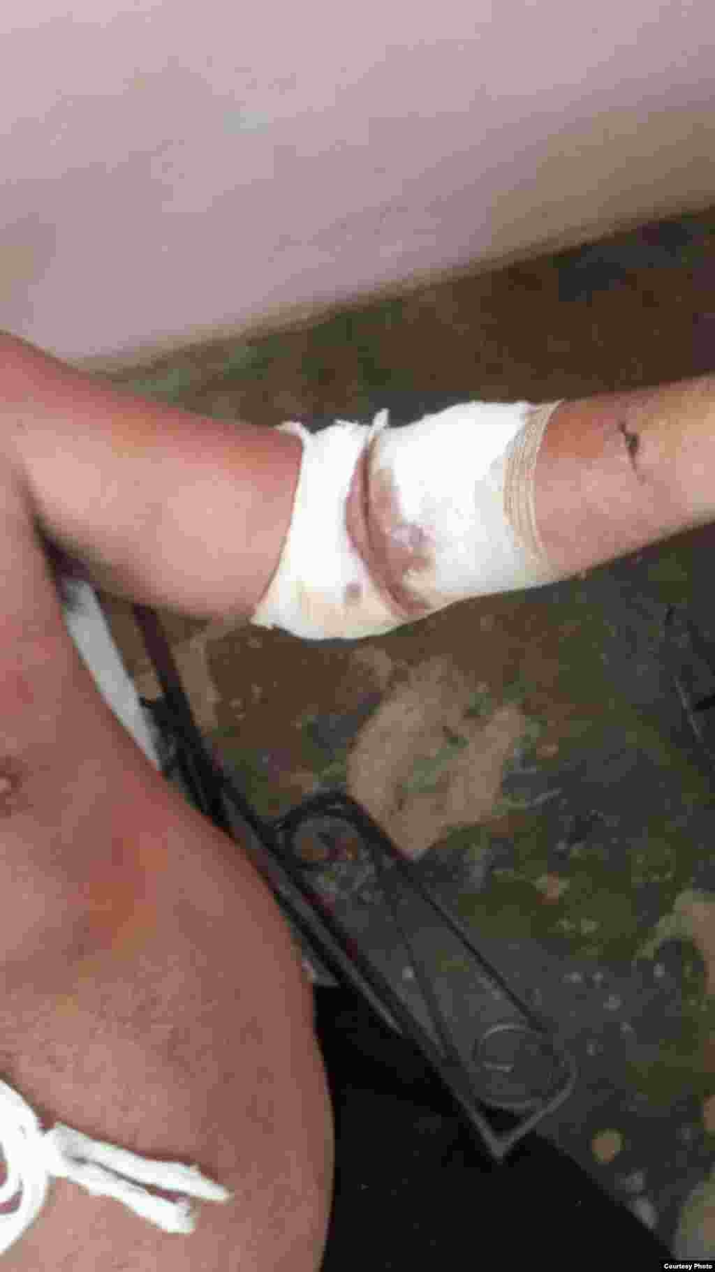 Leonel Murgado resultó herido al tratar de salvar a su sobrino, que falleció por apuñalamiento en el hecho violento ocurrido el 22 de agosto de 2024 en Bauta, provincia Artemisa.