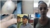 Keilylli muestra los golpes que recibió y el policía que la maltrató.
